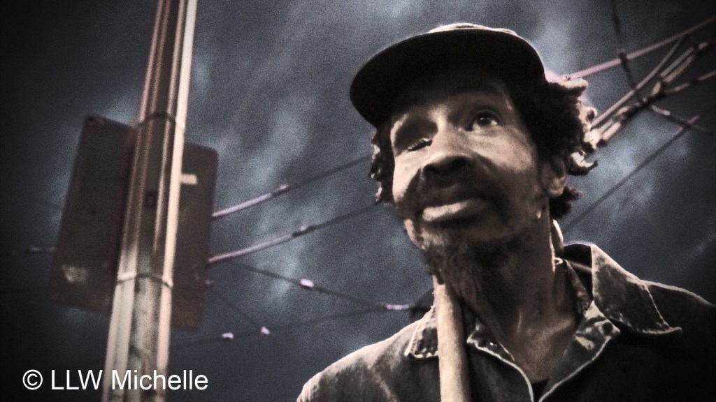 Faces of the homeless “Bone&nbsp;Disease”