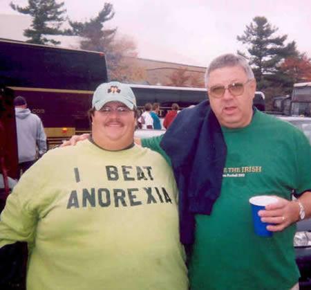 Overweight man wearing tshirt he beat anorexia