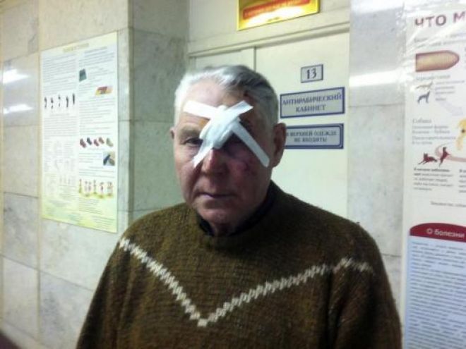 February 15, 2013: A man identifying himself as Viktor poses for a photograph after receiving treatment for injuries sustained from a shock wave that followed after a falling object was sighted in the sky in the Urals region, at an emergency room in a hospital in Chelyabinskk, Russia.Source: Reuters
