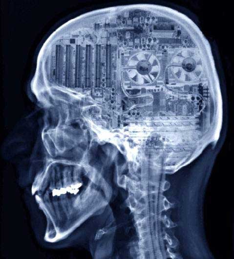 nerd brain xray